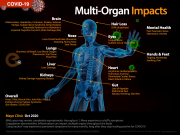 COVID impacts organs and systems throughout the body, sometimes with long-lasting effect.
